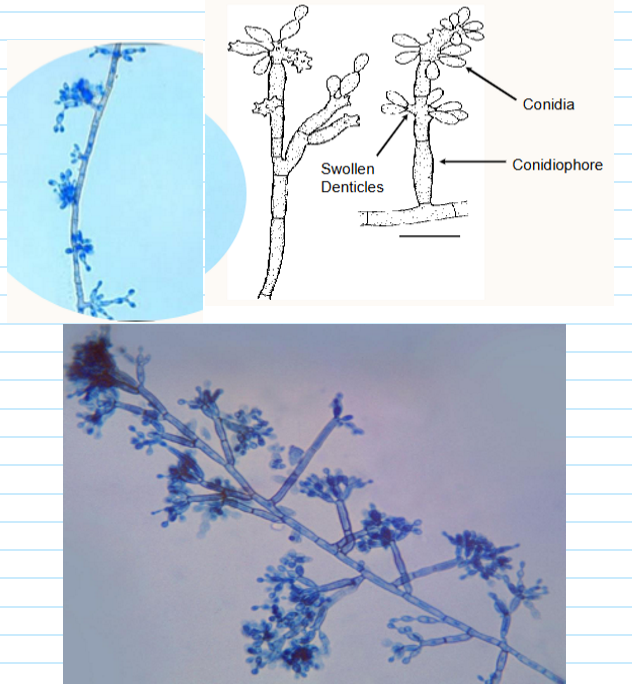 <ul><li><p><span>A mould of many hats</span></p></li><li><p><span>4 sporulation patterns (1st pic)</span></p><ul><li><p><span>a. Fonsecaea type ; b. Cladosporium type</span></p></li><li><p><span>c. Rhinocladiella type ; d. Philophora type</span></p></li></ul></li><li><p>Fonsecaea type:</p><ul><li><p><span>Denticle--short stalk-like structure from which conidia arise</span></p><ul><li><p><span>Hard to see; Can be thin or swollen</span></p></li></ul></li></ul></li></ul><p></p>