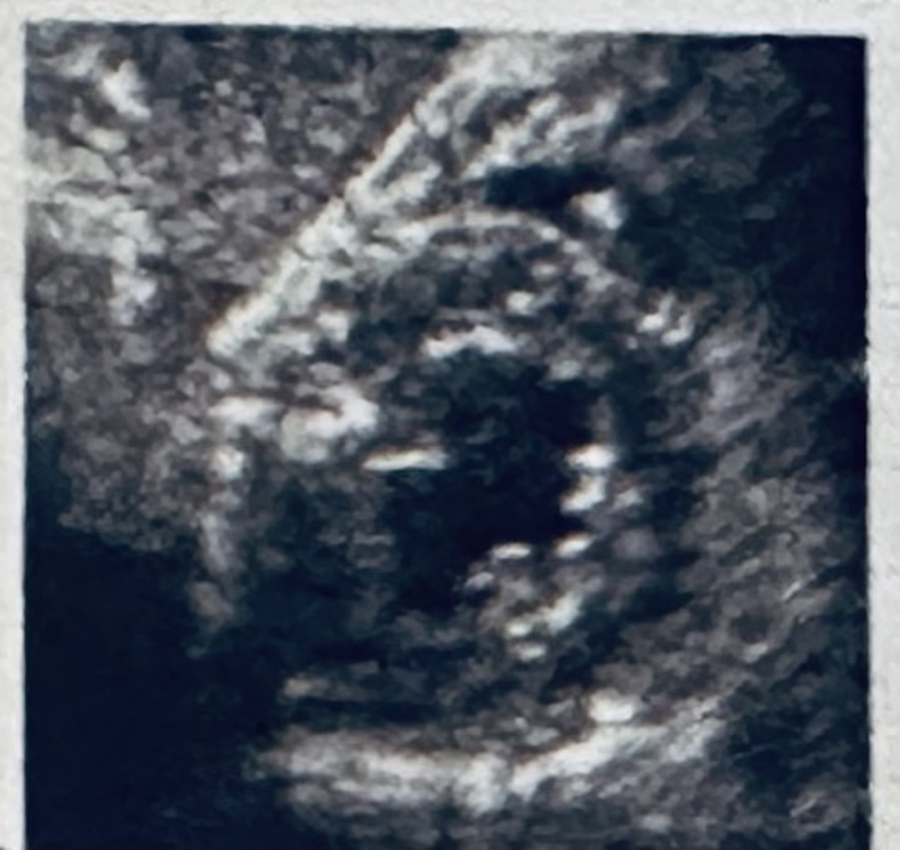 <p></p>