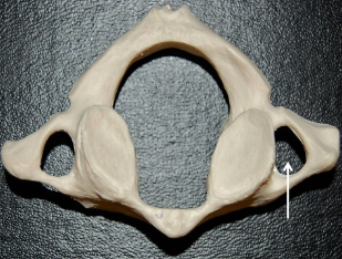 The openings in the cervical vertebrae for the transmission of the vertebral artery and vein are called the: