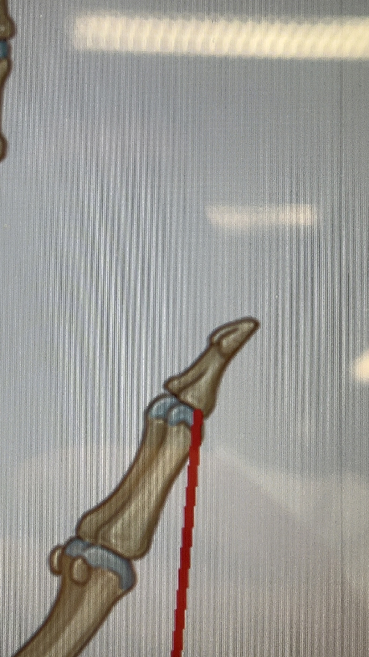 term image