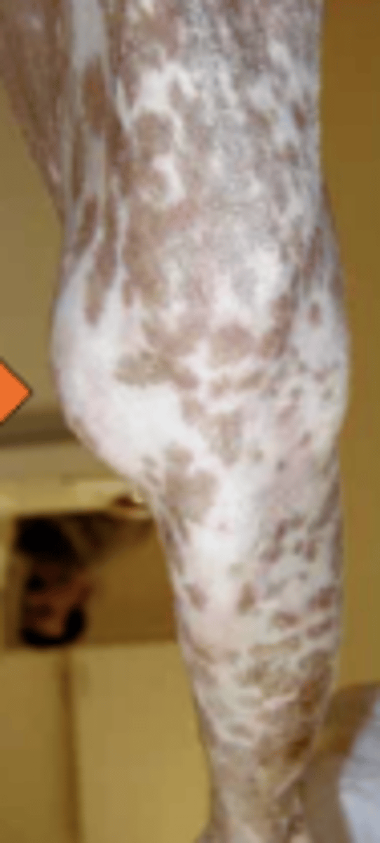 <p>What does medial buttress of the stifle joint/proximal medial tibia indicate?</p>