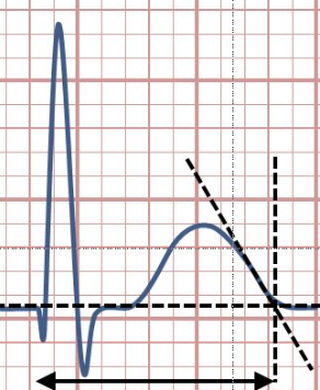 <p>time for ventricular repolarization is complete</p>
