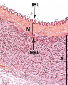 <ul><li><p>It contains layers of smooth muscles cells and some elastic fibers</p></li><li><p>Prominent internal elastic lamina (IEL) and less accentuated external elastic lamina (EEL, absent in smaller muscular arteries)</p></li><li><p>M, <em>tunica media</em></p></li><li><p>A, <em>tunica adventitia</em></p></li></ul><p></p><p></p>