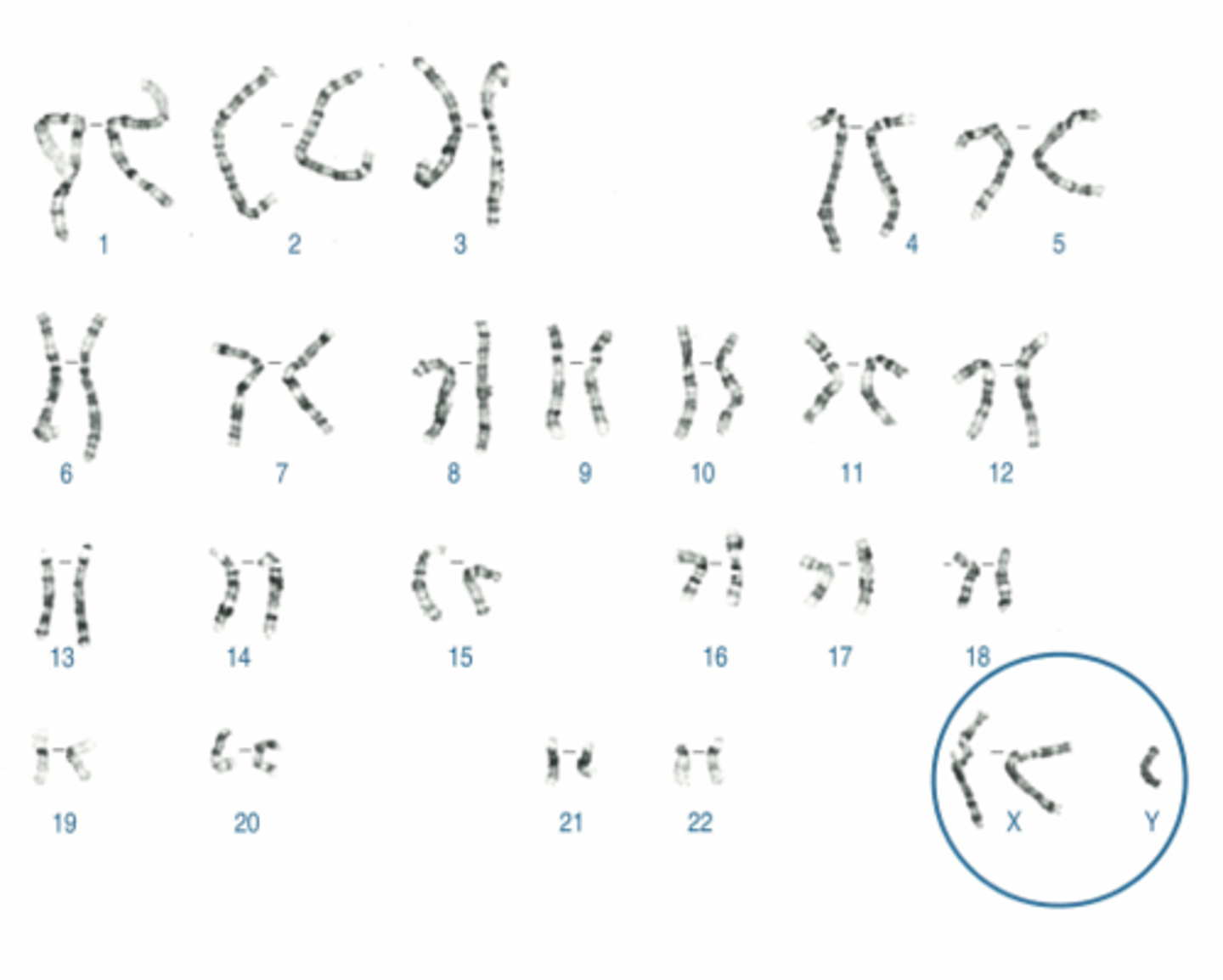 <p>Name:</p><p>- Correctly written karyotype</p><p>- Common name</p><p>- Scientific name</p><p>- One distinguishing clinical feature</p><p>- Definition of this feature if not obvious</p>