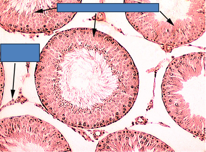 <p>Identify this structure</p>