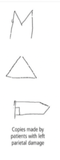 <p>The left parietal lobe is important for specific features</p><ul><li><p>Able to reproduce global features of the pictures but not specific features </p></li></ul>