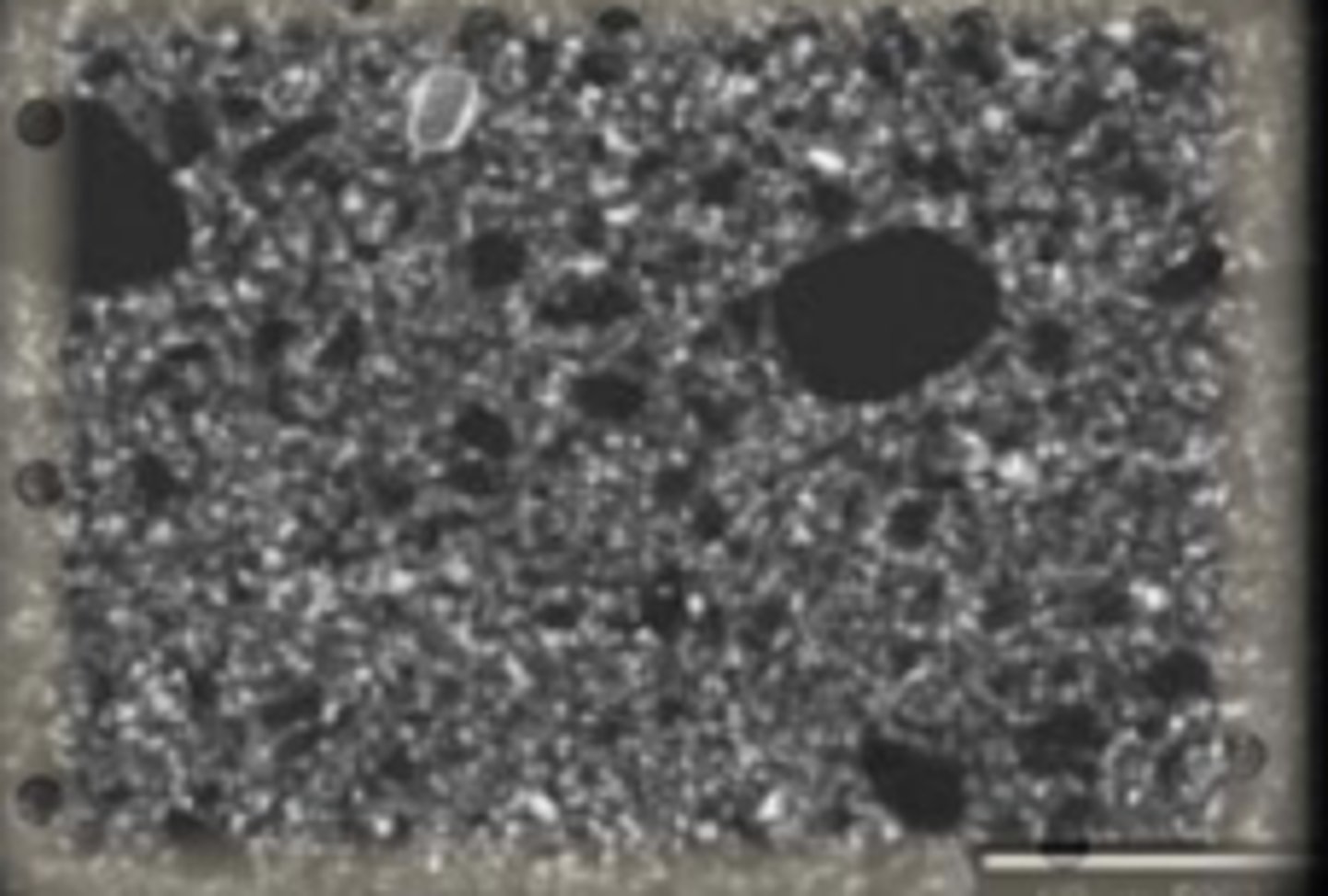 <p>40-50 nanometer sized fillers, pre-polymerizated filled resin particle mixed with the monmers</p><p>Polished to the highest luster and smoothest surface</p><p>Not as strong as other RB- low stress bearing and esthetic areas</p>