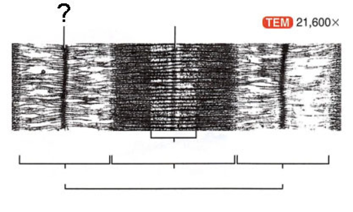 <p>sarcomere boundary</p>