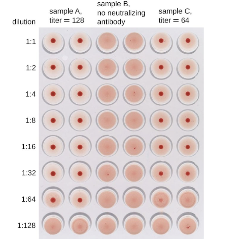<p><span><span>In this HIA, serum containing antibodies to influenzavirus underwent serial two-fold dilutions in a microtiter plate.</span></span><br><span><span>Red blood cells were then added to the wells. Agglutination only occurred in those wells where the antibodies were too dilute to neutralize the virus. The highest concentration at which agglutination occurs is the titer of the antibodies in the patient’s serum. In the case of this test, Sample A shows a titer of 128, and Sample C shows a titer of 64. (credit: modification of work by Evan Burkala)</span></span></p>