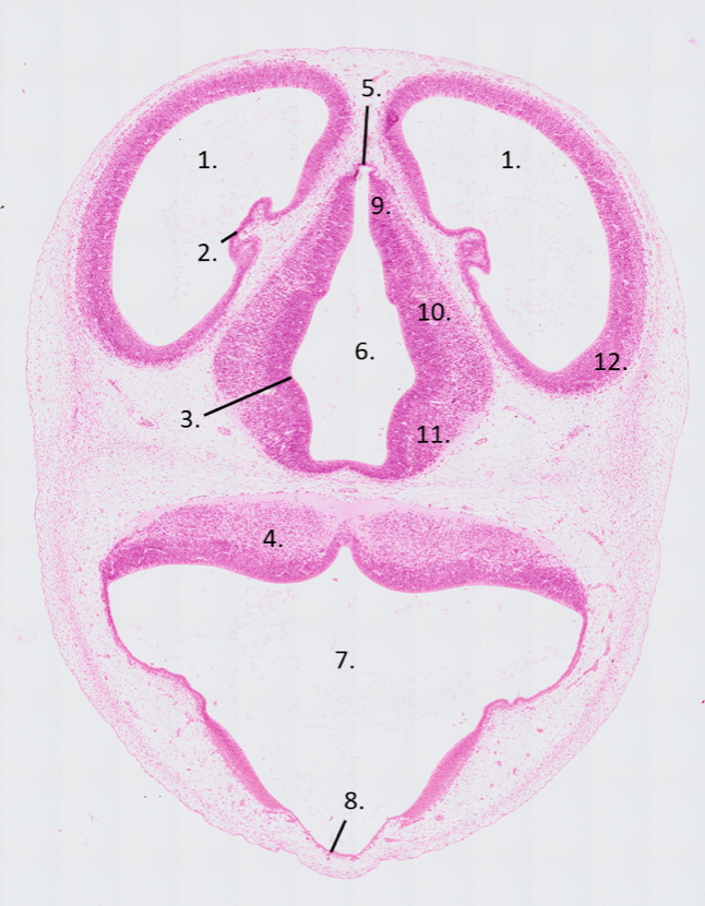 <p><span>Shown is a transverse section of a 14-day old rat embryo. The telencephalon, diencephalon and myelencephalon are visible. Name the numbered structures.</span></p>