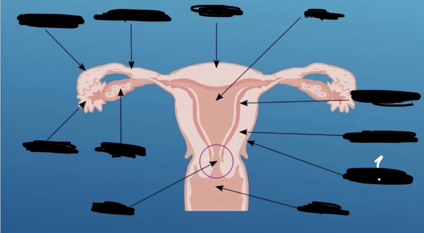 What is the arrow pointing to?