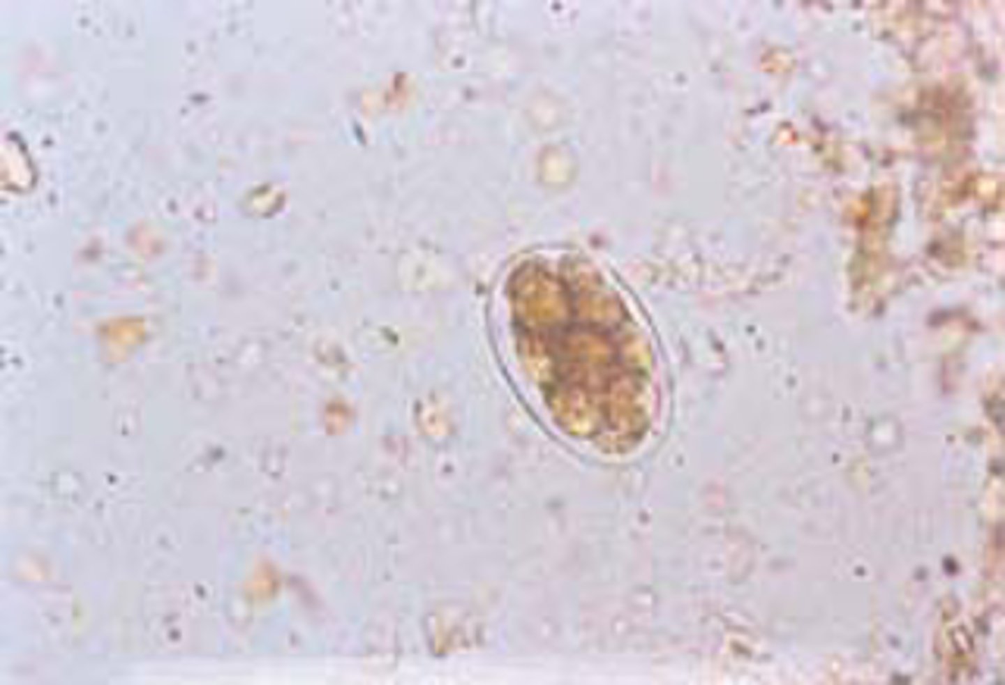 <p>Eggs broadly oval, thin, colorless shell, 4-8 cell stage embryo when passed in stool (rhabditiform larvae rarely seen in stool)</p>