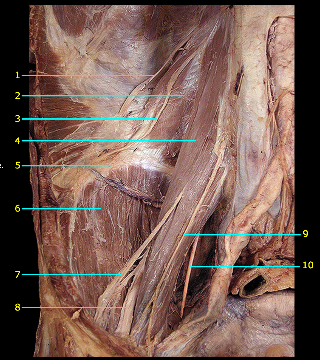 <p>What structure is labeled 1?</p>