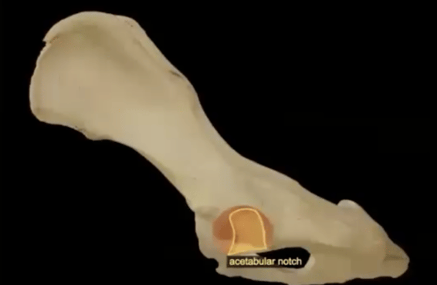 <p>incomplete wall on the inferior surface of the acetabulum</p>