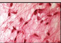 <ul><li><p>Loose arrangement of fibers</p></li><li><p>A lot of ground substance</p></li><li><p>Scattered Cells</p></li><li><p>Located in every organ</p></li></ul><p></p>