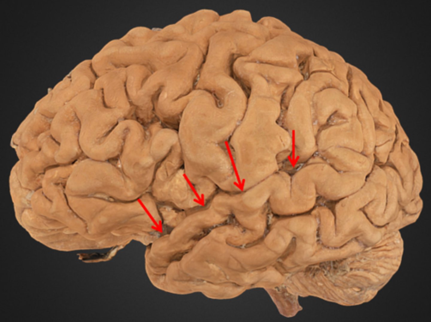 <p>The boundary between the frontal and temporal lobe.</p>