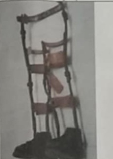 <p>Bilateral Long Leg Brace</p>