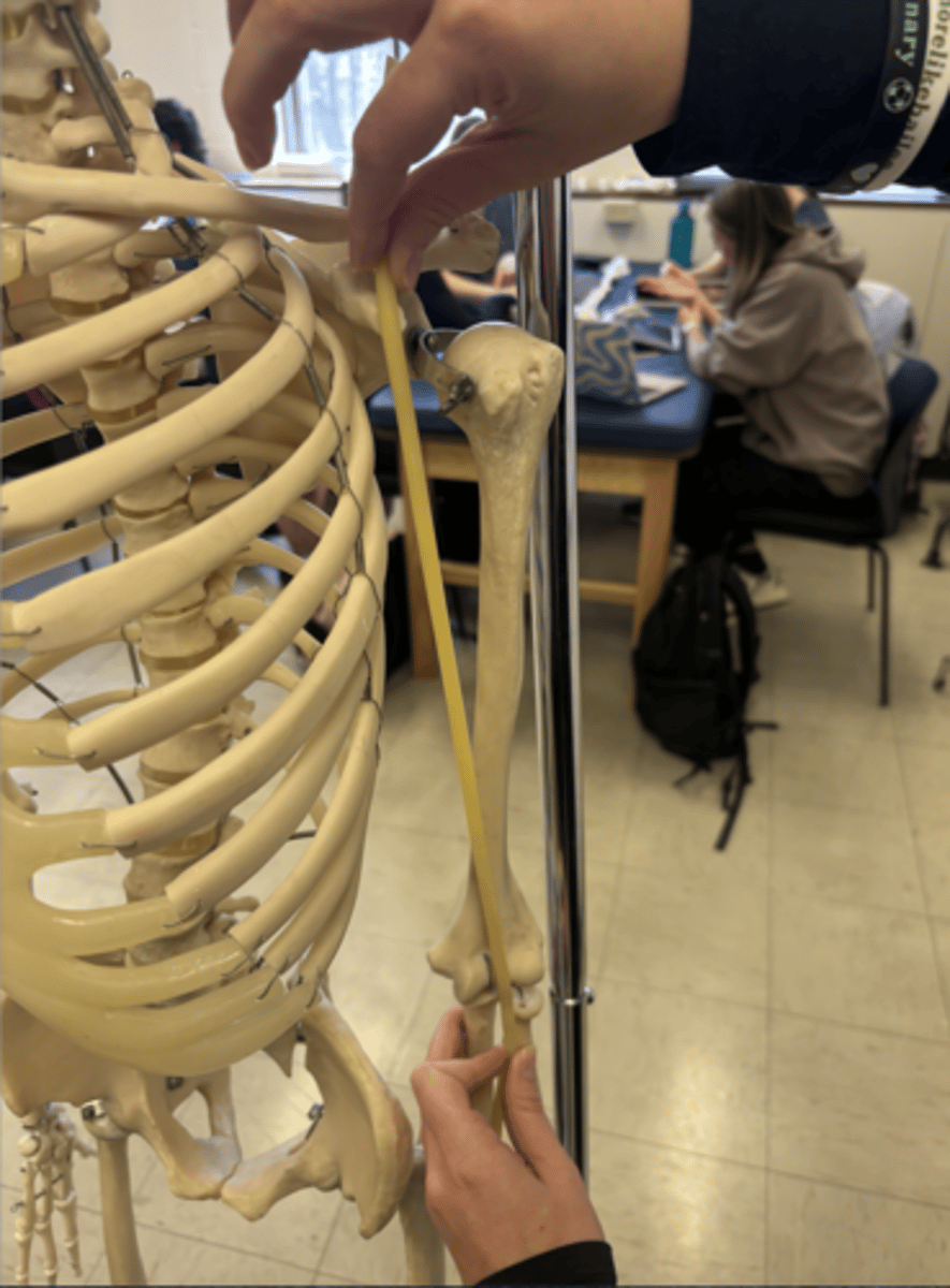 <p>What is this muscle?</p>