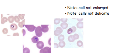 <p>What is the genus, species, and stage of this parasite?</p>