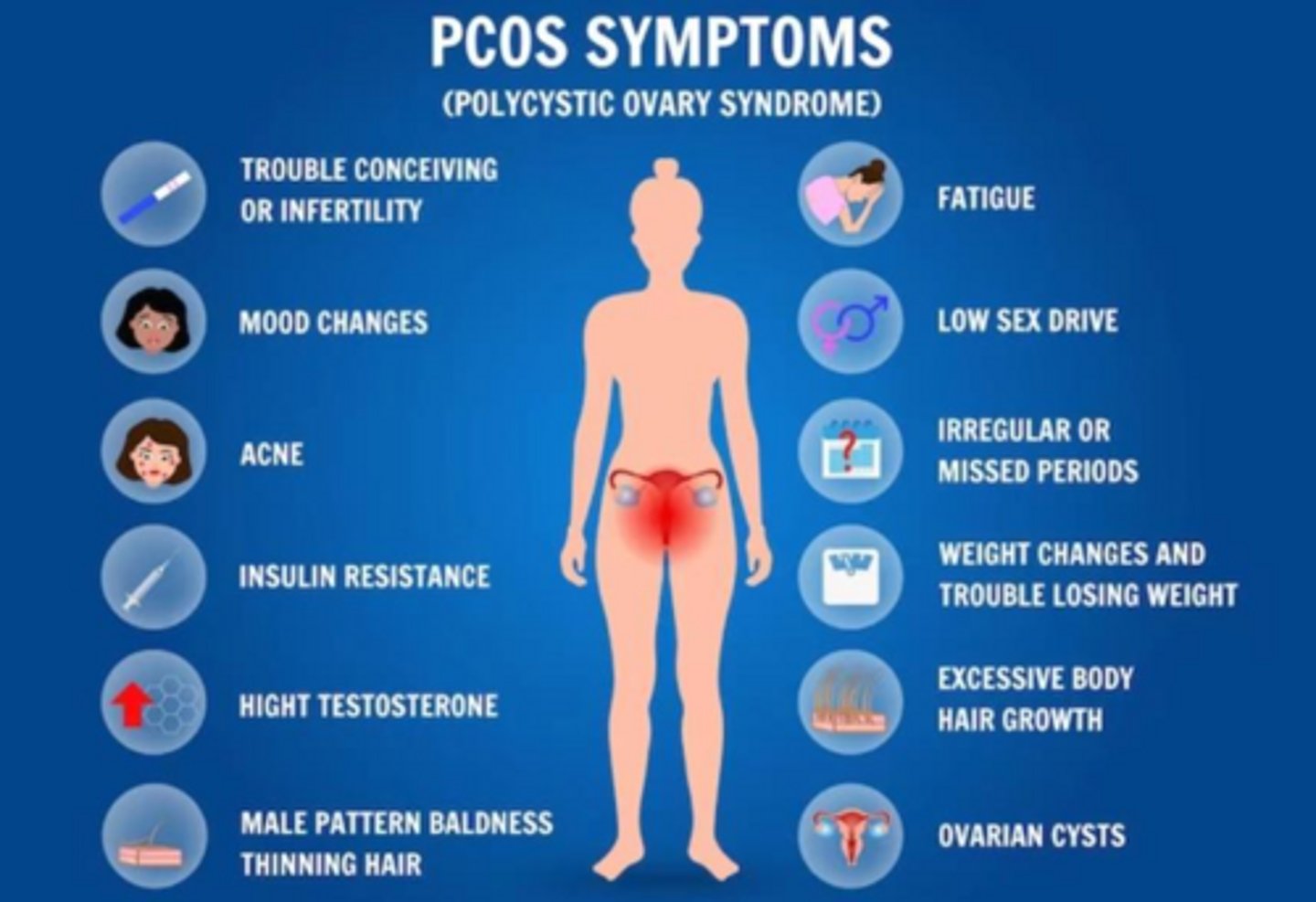<p>Polycystic Ovarian Syndrome (PCOS).</p>