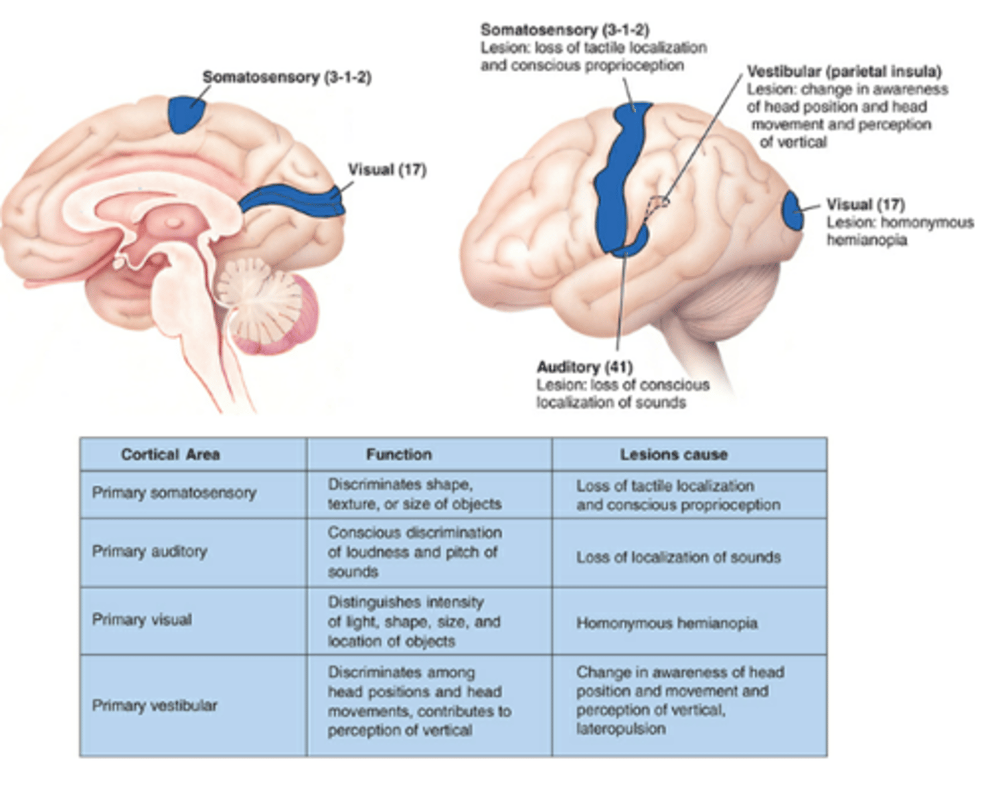 <p>loss of tactile localization and conscious proprioception</p><p>(impairs ability to discriminate intensity or assess quality)</p>