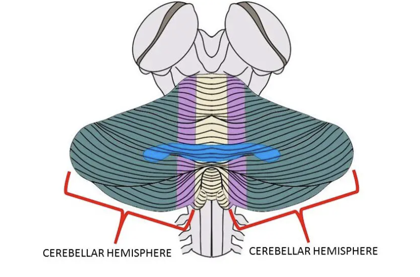 <p>cerebellar hemispheres</p>