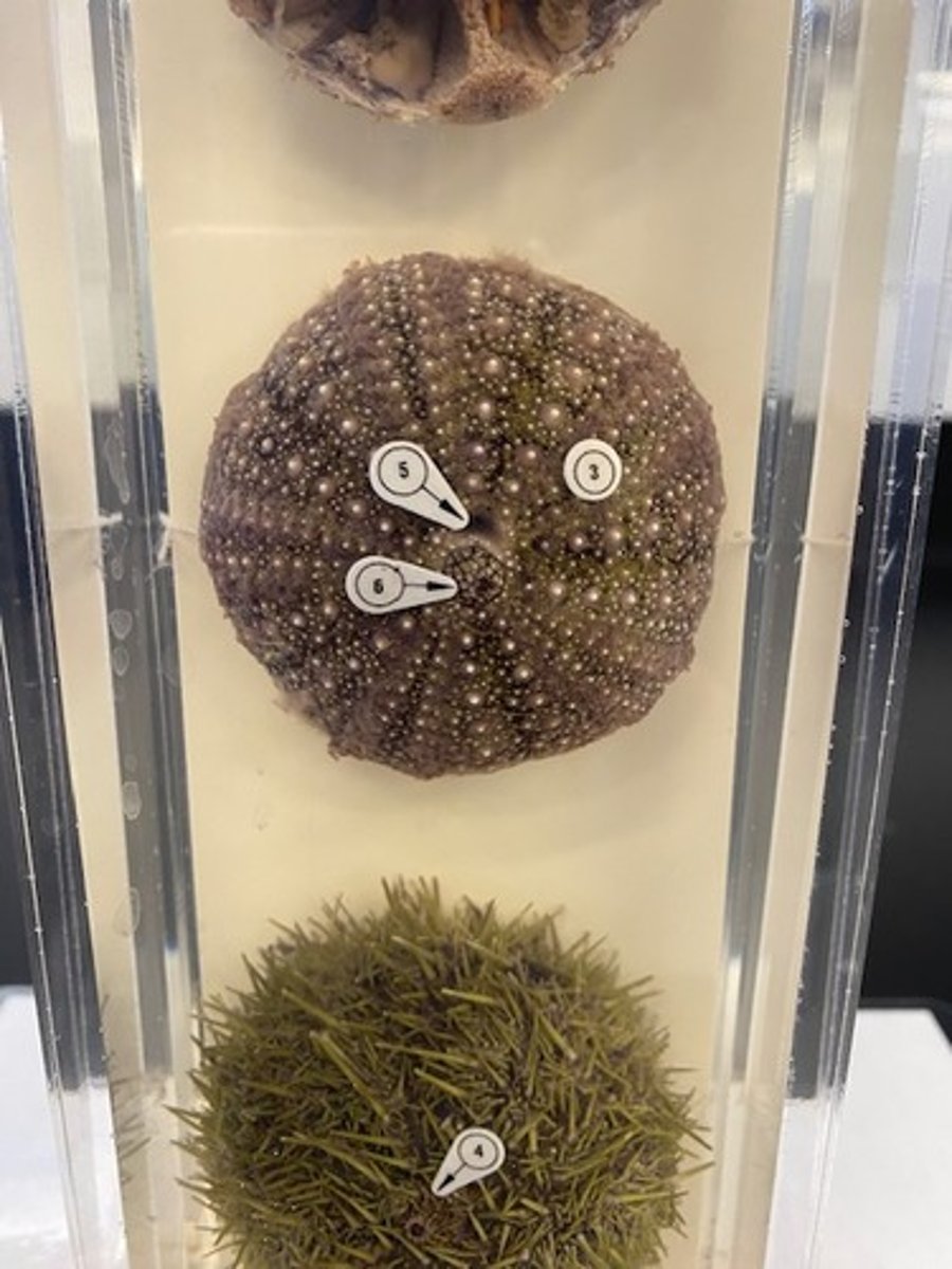 <p>What is structure number 5?</p>