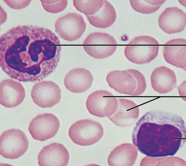 <p>Spread out, bunch of circular shapes with larger circles mixed in (white blood cells)</p>