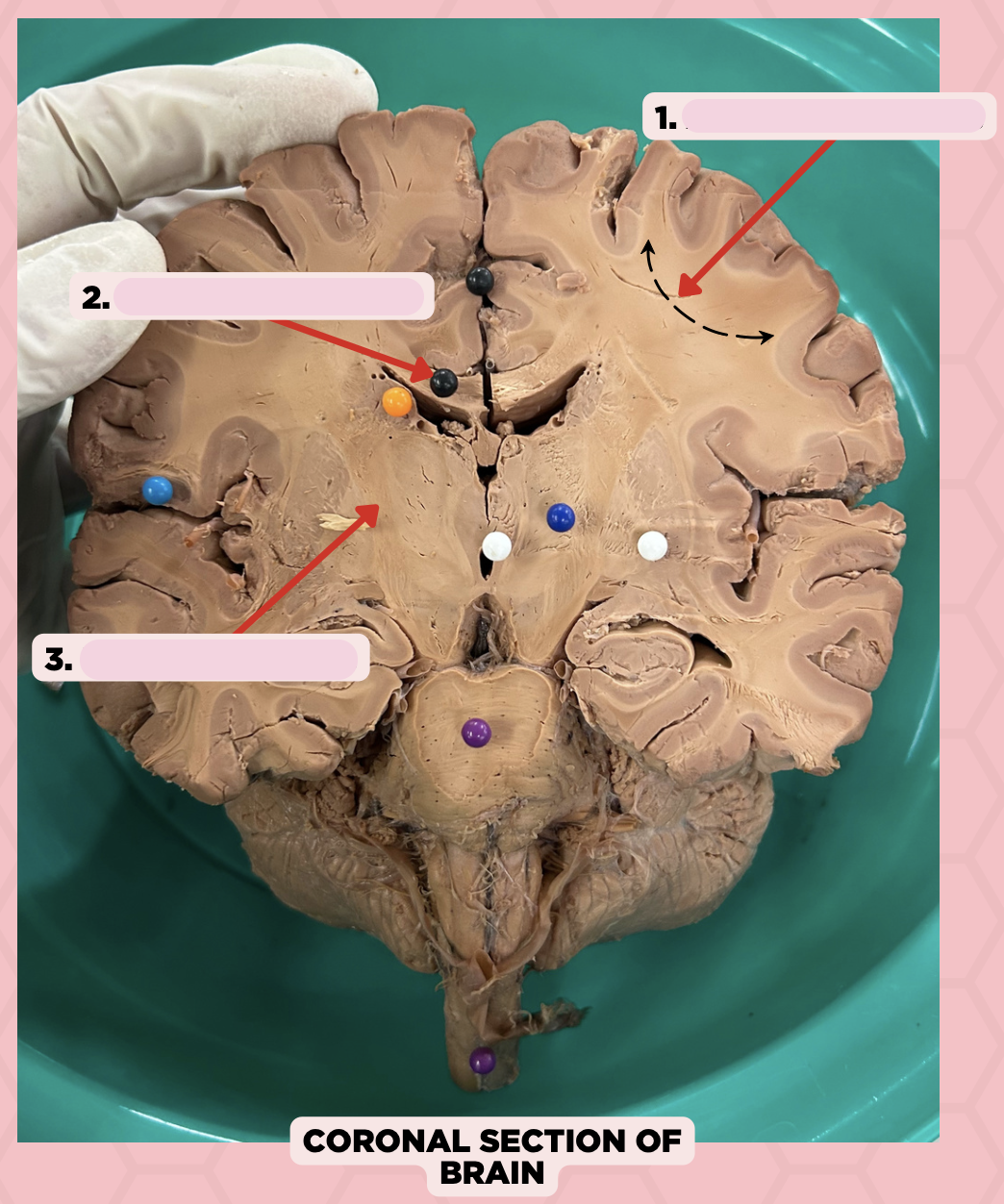 <p>Identify the structure labeled as 2.</p>