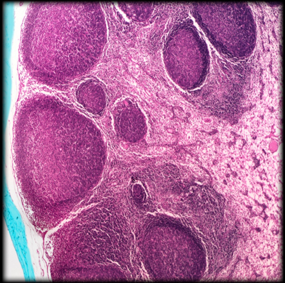 <p>Lymph node</p>