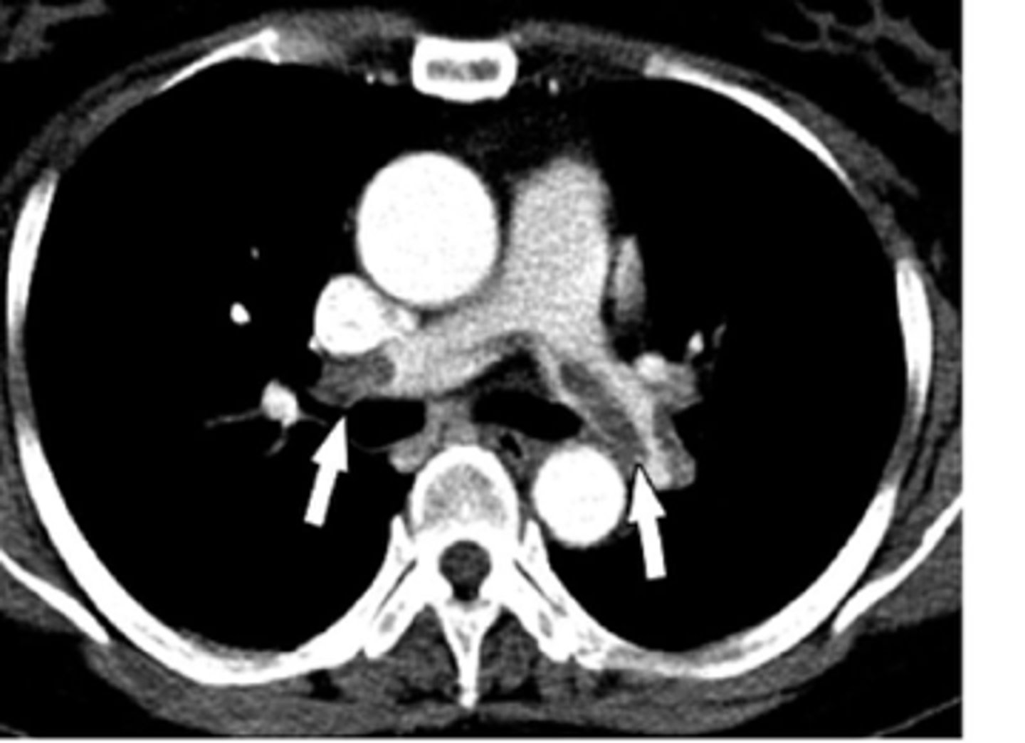 <p><em>identify the pathology:</em></p>