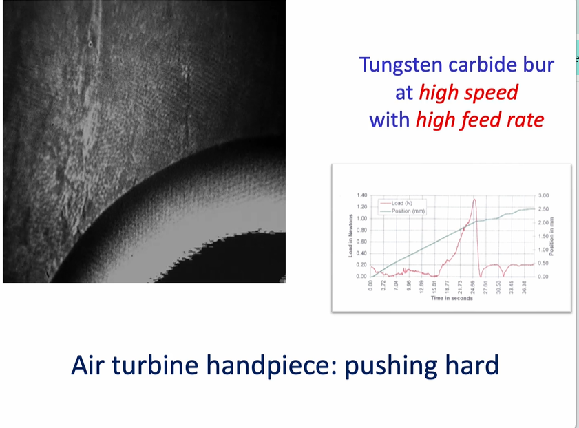 <ul><li><p>tungsten carbide bur at <strong>high speed </strong>with a high feed rate &nbsp;</p></li><li><p>air turbine handpiece - <strong>pushing hard </strong>- then the handpiece - handpiece starts to stall - bur will then stall, then recover, then stall then recover → this creates a <strong>rippling effect </strong></p></li><li><p>this causes quite a lot of <strong>damage to the substrate </strong></p></li><li><p>this is <strong>uncomfortable for the patient - </strong>and is <strong><em>not</em></strong> an efficient was of cutting the tissue </p></li></ul><p></p>