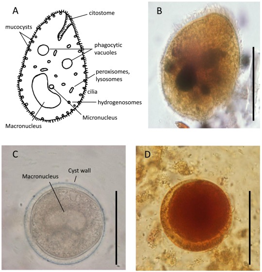 <p>Balantidiasis</p><p>Protozoa - Chromalveolata</p><p>parasitic intestinal illness, rarely serious unless immunocompromised</p><p> ciliated, apical complex</p>
