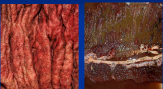 <p><span style="background-color: transparent;">Larval Cyathostomiasis</span></p>