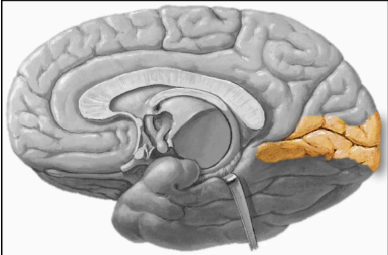 <p>CALCARINE SULCUS</p>