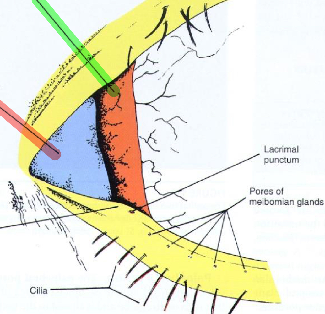 What structure is indicated by the green arrow?