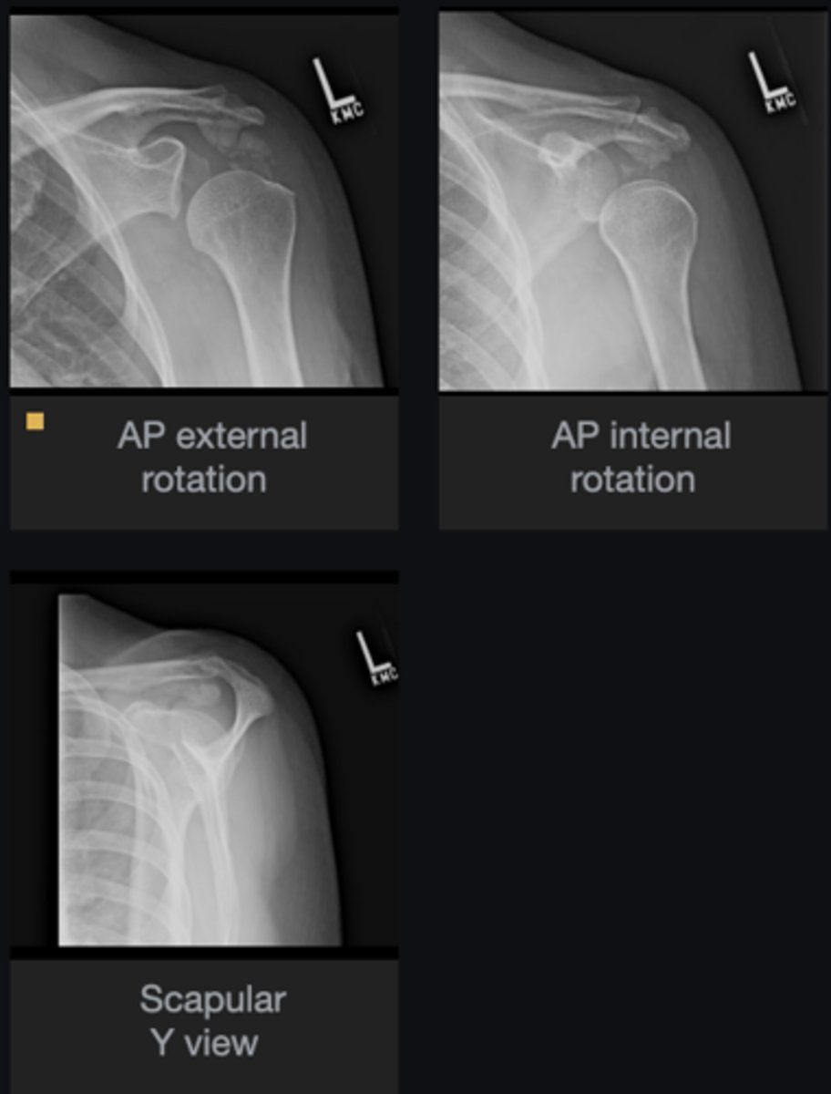<p>List the abnormal findings</p>