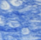 <p>Which type of tissue does this image depict?</p>