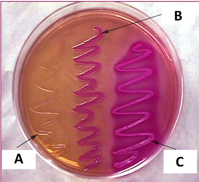 <p>This image shows the results of three different bacterial species grown on MacConkey media. Which bacterial species, if any, are likely Gram-negative?</p>