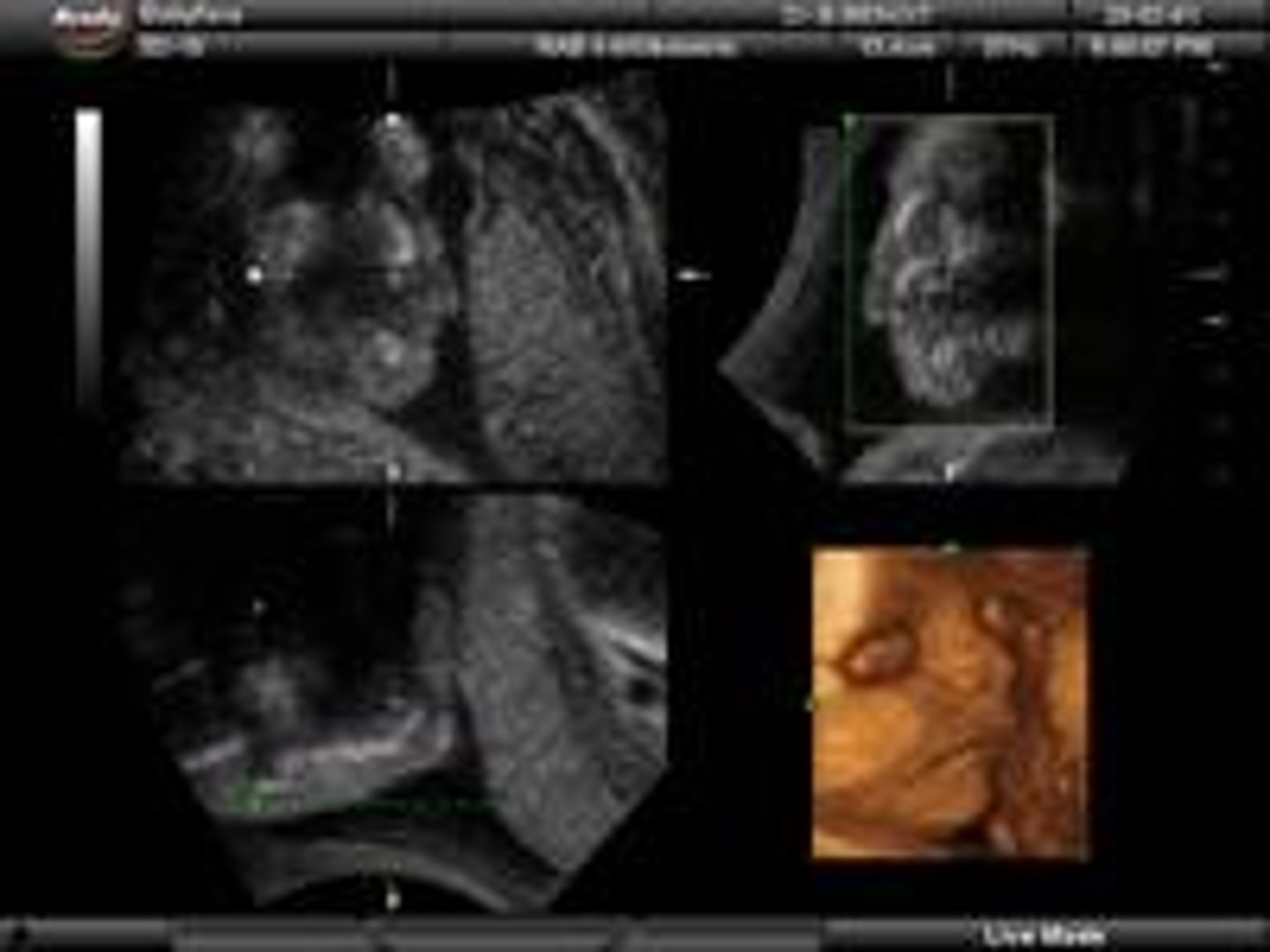 <p>Creates 3D images from multiple 2D scans.</p>