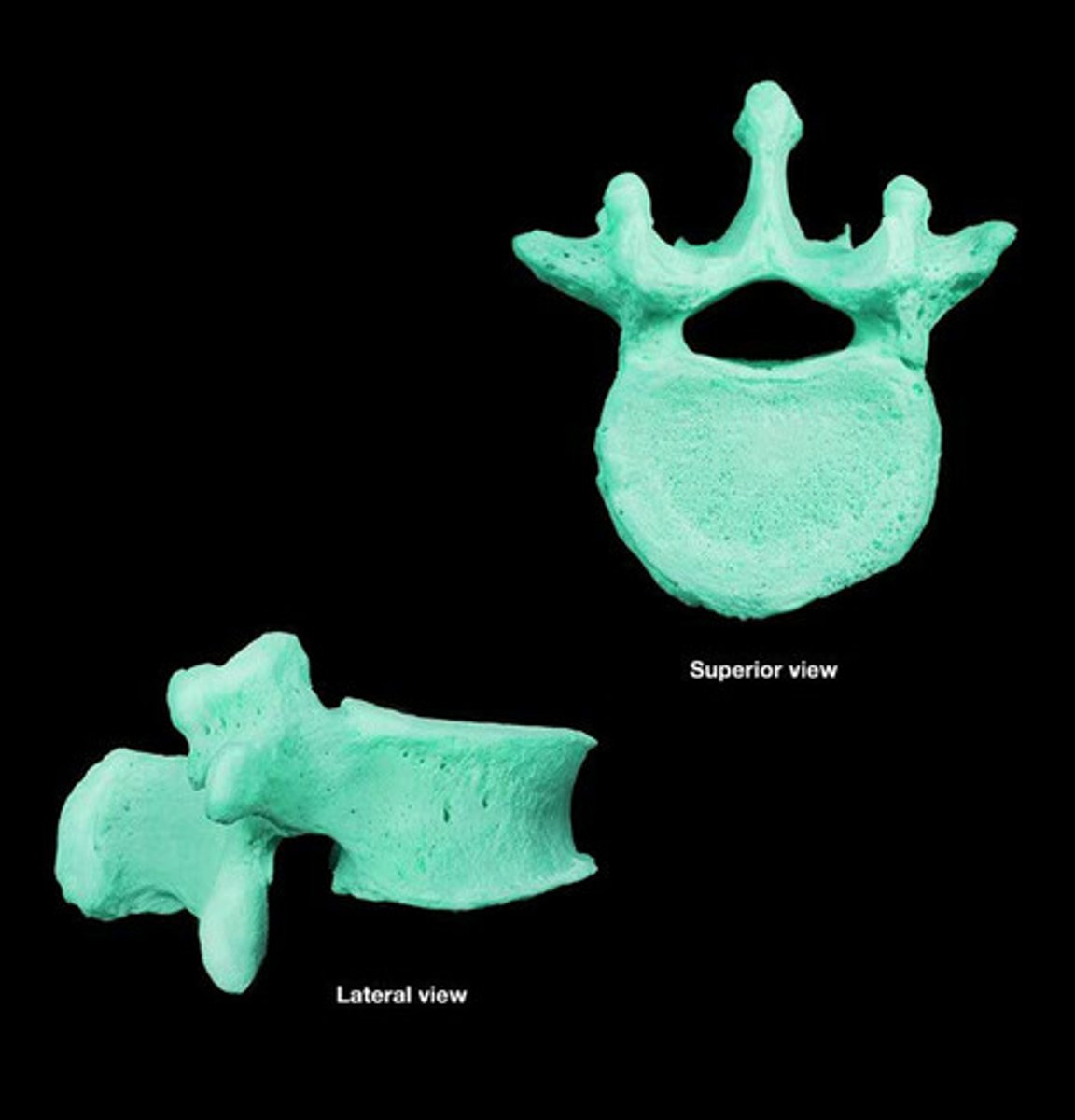 <p>mamillary and accessory process</p><p>small triangular vertebral foramen</p><p>short sturdy rectangular spinous process</p><p>large kidney shaped body</p>