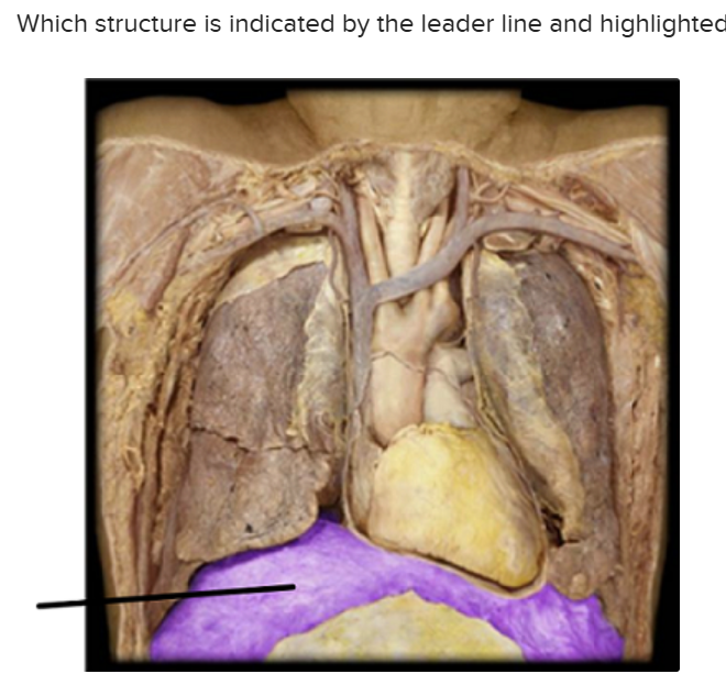<p>The structure highlighted is: </p>