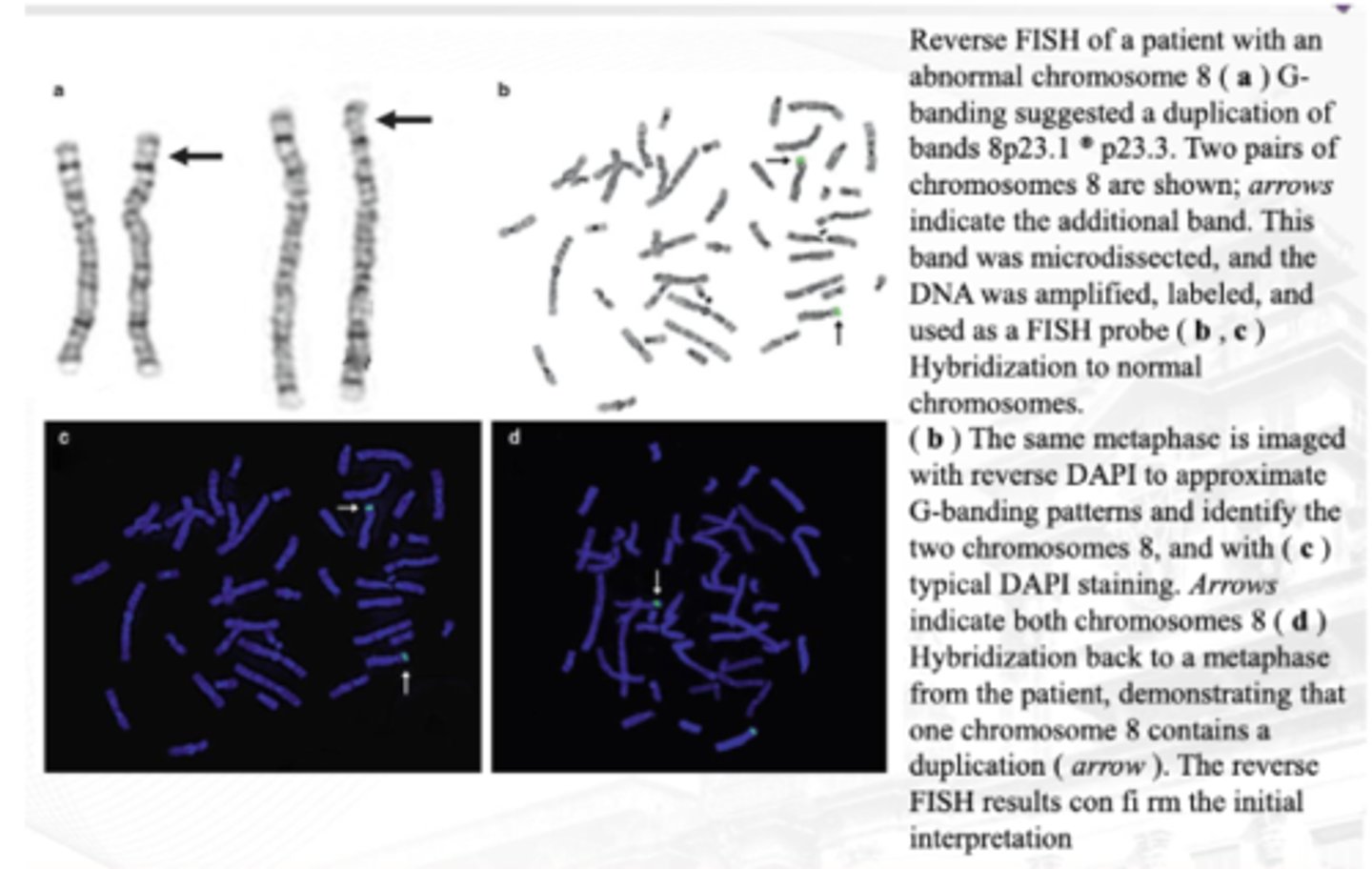 <p>Used to identify material of unknown origin</p><p>This unidentified material, such as a marker chromosome or duplication, is flow sorted or microdissected off a slide after G-banding. The DNA from this material is extracted, PCR-amplified, and labeled with a fluorochrome. This is then used as a probe and hybridized to normal or patient metaphase chromosomes to identify the origin of the unknown material</p>