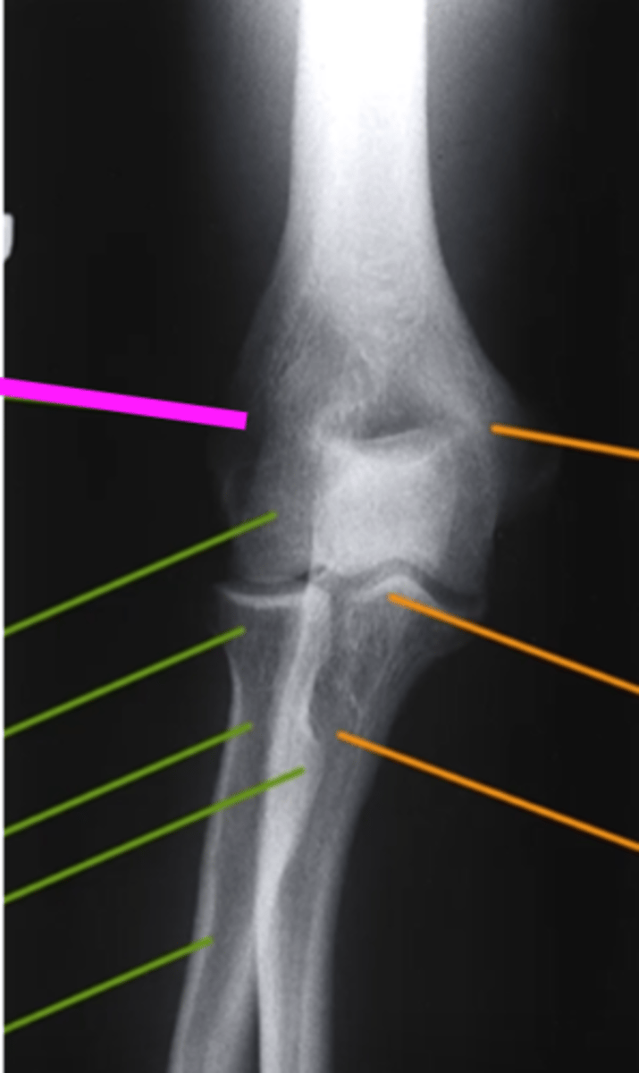 <p>what does the pink line point to?</p>