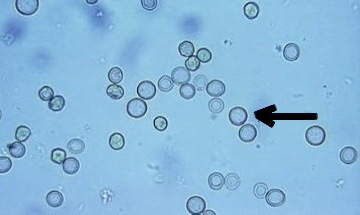 <ol><li><p>Identify structure.</p></li><li><p>What cell may this structure resemble?</p></li></ol><p></p>