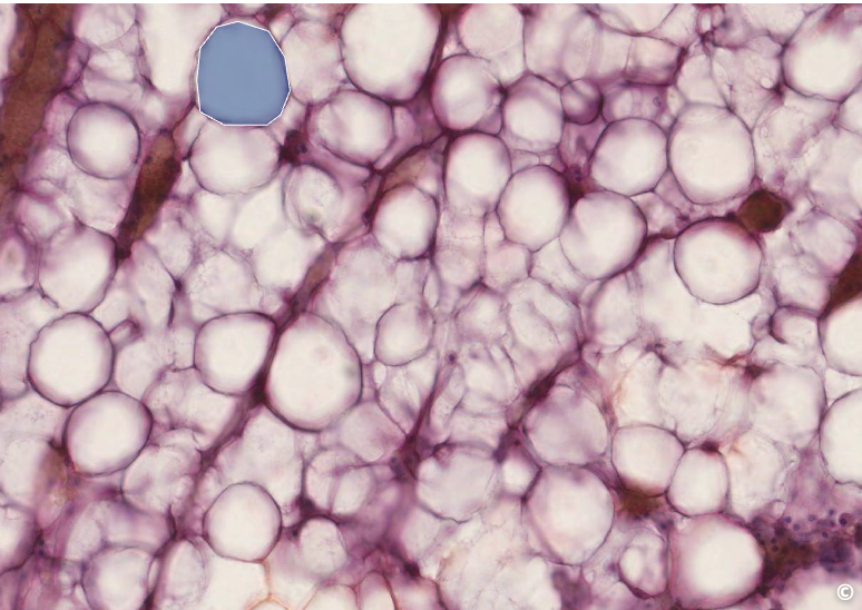 <p>identify area of histological slide, type of CT, and identify structures</p>