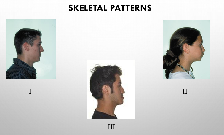 <p>-cephalometric analyses reveal the skeletal component of the patient’s malocclusion in relation to cranial base</p><p>-can classify patients as: class I/II/III skeletal pattern</p><p>-patterns often correspond with the dental molar angle classification but not necessarily all the time- understanding the skeletal pattern is essential for choosing the proper treatment objectives and plan</p>
