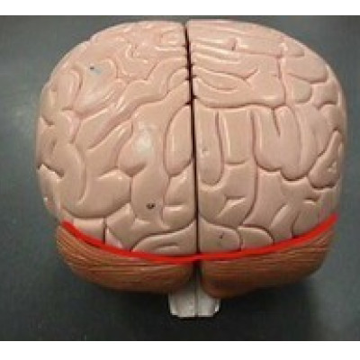 term image