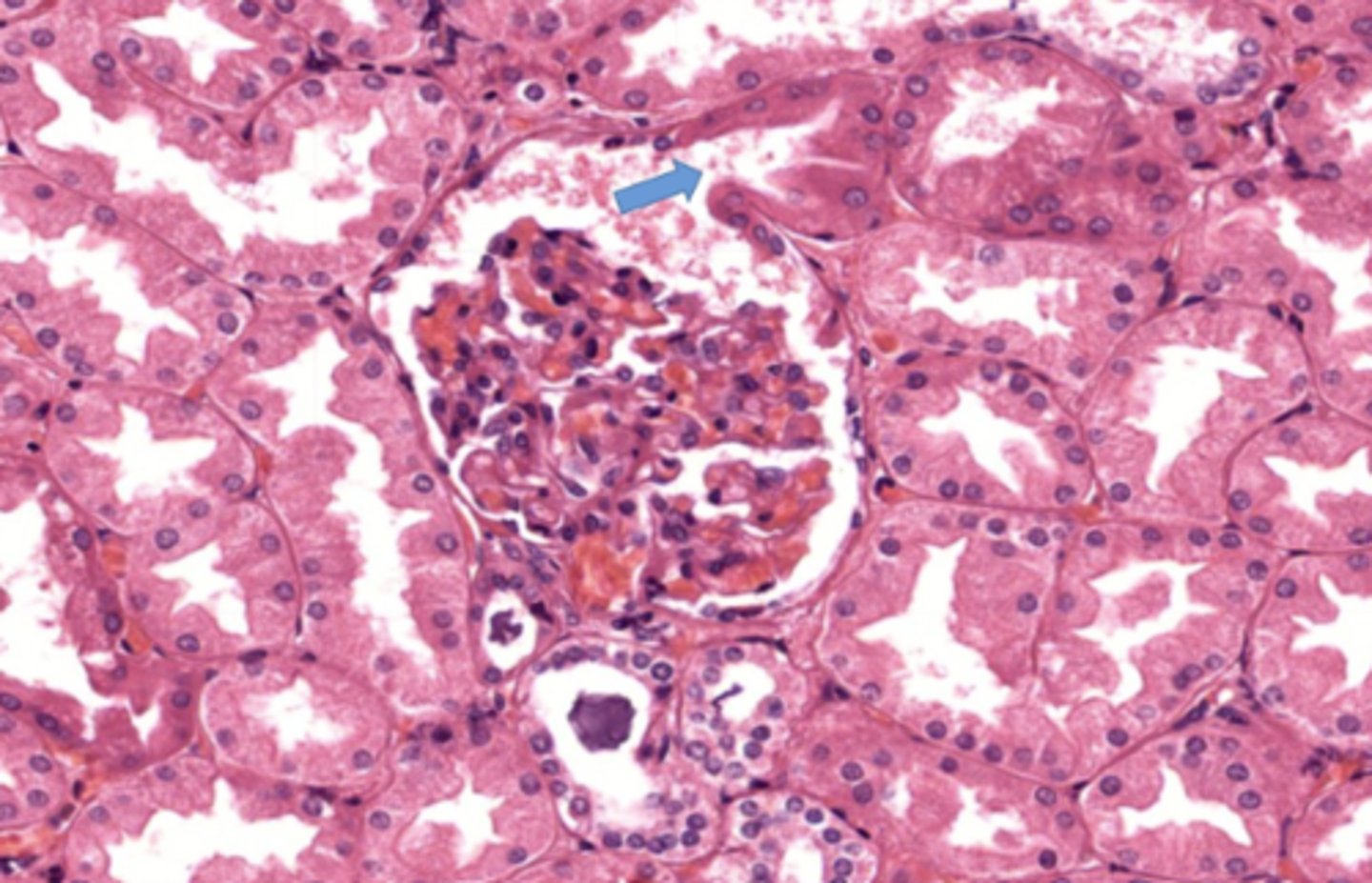 <p>The arrow shows where filtrate enters what segment of the nephron</p>