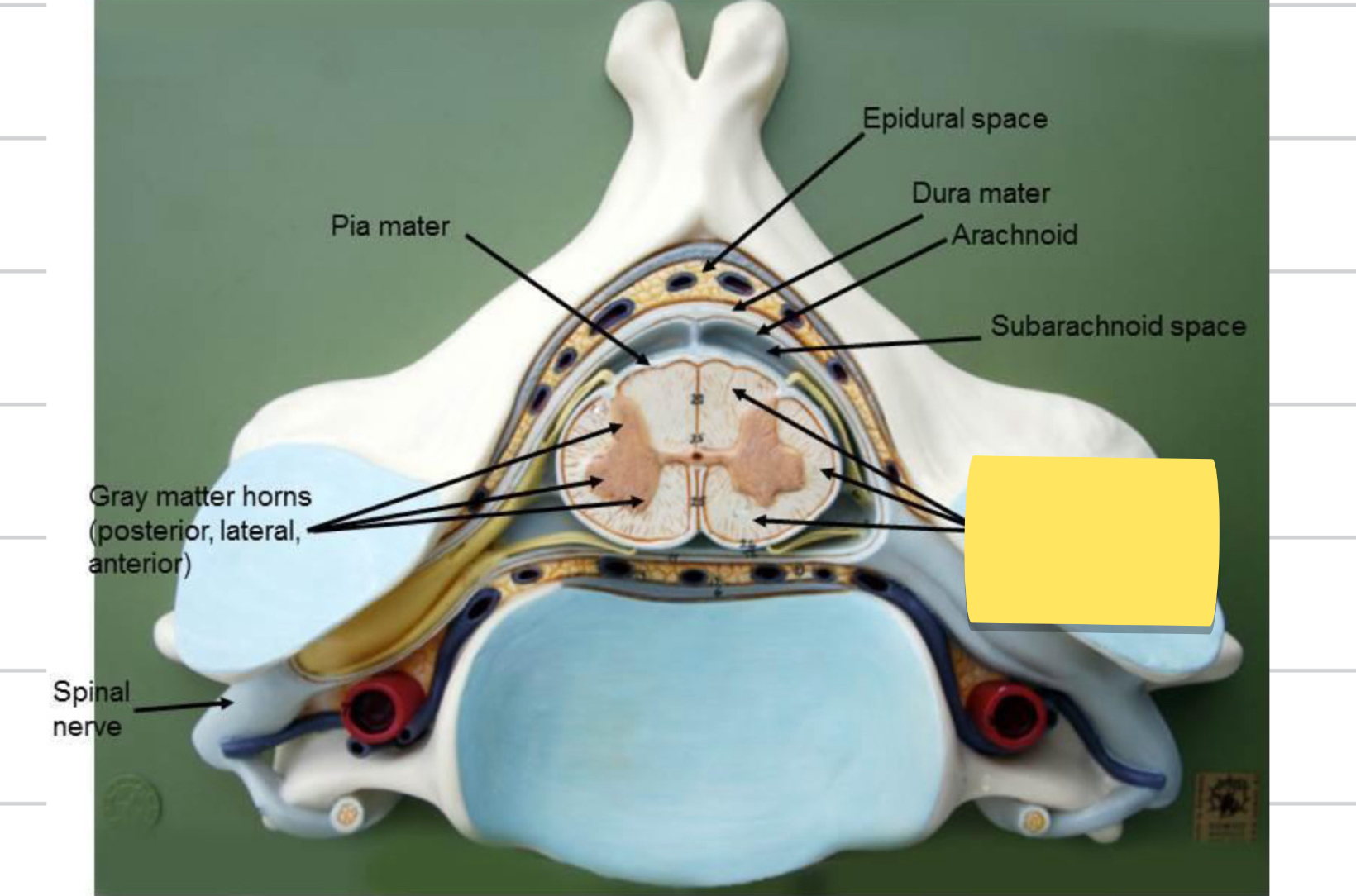 <p>Name this spinal cord part</p>
